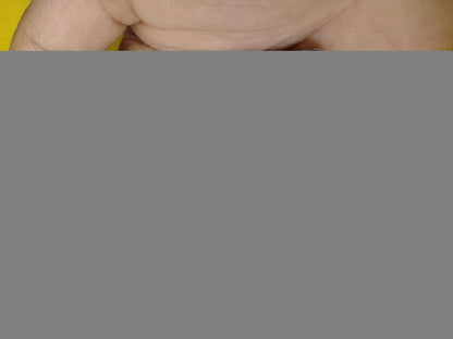 Motion Sickness Relief Wristbands | FLAT 50% SAVING